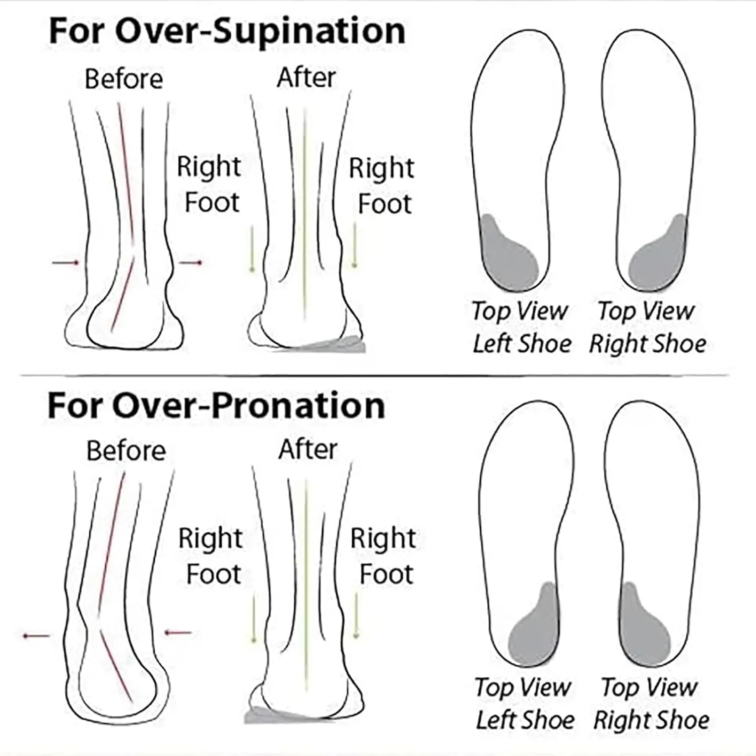Women's Soft Sole Mesh Comfort Orthopedic Shoes, Casual Slip on Comfort Wear Shoe, Low-Top Breathable Flat Shoe for Women